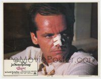 7j133 CHINATOWN LC #5 '74 best close up of Jack Nicholson with bandaged nose, Roman Polanski!