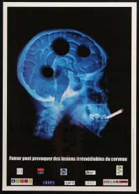 4z346 FUMER PEUT PROVOQUER DES LESIONS IRREMEDIABLES DU CERVEAU 12x17 French special poster 1990s