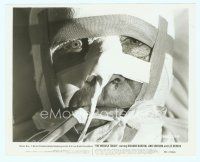 6a373 MEDUSA TOUCH 8x10 still '78 extreme close up of bandaged bruised Richard Burton!