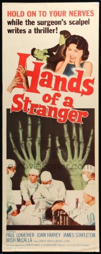5g681 HANDS OF A STRANGER insert '62 cool hand transplant surgery & X-ray image!