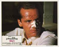 8z208 CHINATOWN LC #5 1974 best close up of Jack Nicholson with bandaged nose, Roman Polanski!