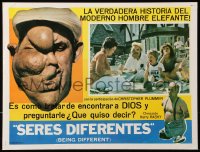 9t332 BEING DIFFERENT Mexican LC 1985 documentary about people with physical deformities, rare!